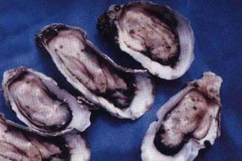 �������Y